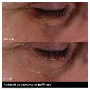 Double Serum Eye - Traitement Yeux Jeunesse Intensif